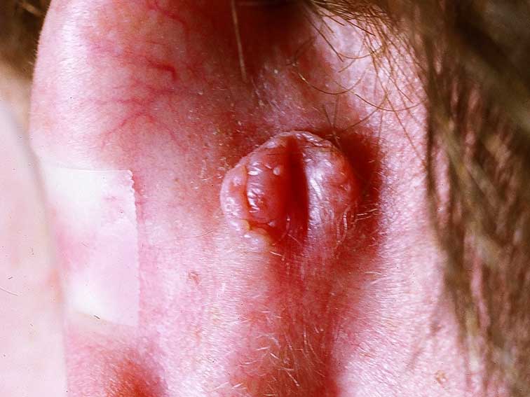 Spot Diagnosis