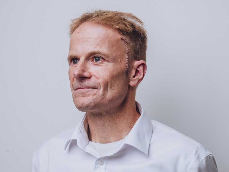 Amazing Professor Richard Scolyer’s Advice To 2026 Graduates Design Collection Amazing Professor Richard Scolyer’s Advice To 2026 Graduates Design Collection
